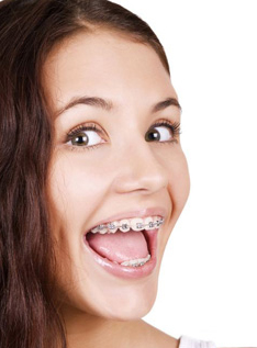 Smile Style Starts in Sugarland–Trusted Orthodontic Experts