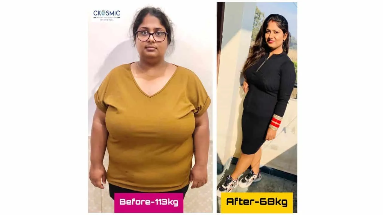 Meet Dr. Amit Sood – Expert Bariatric Surgeon at CKOSMIC Health City