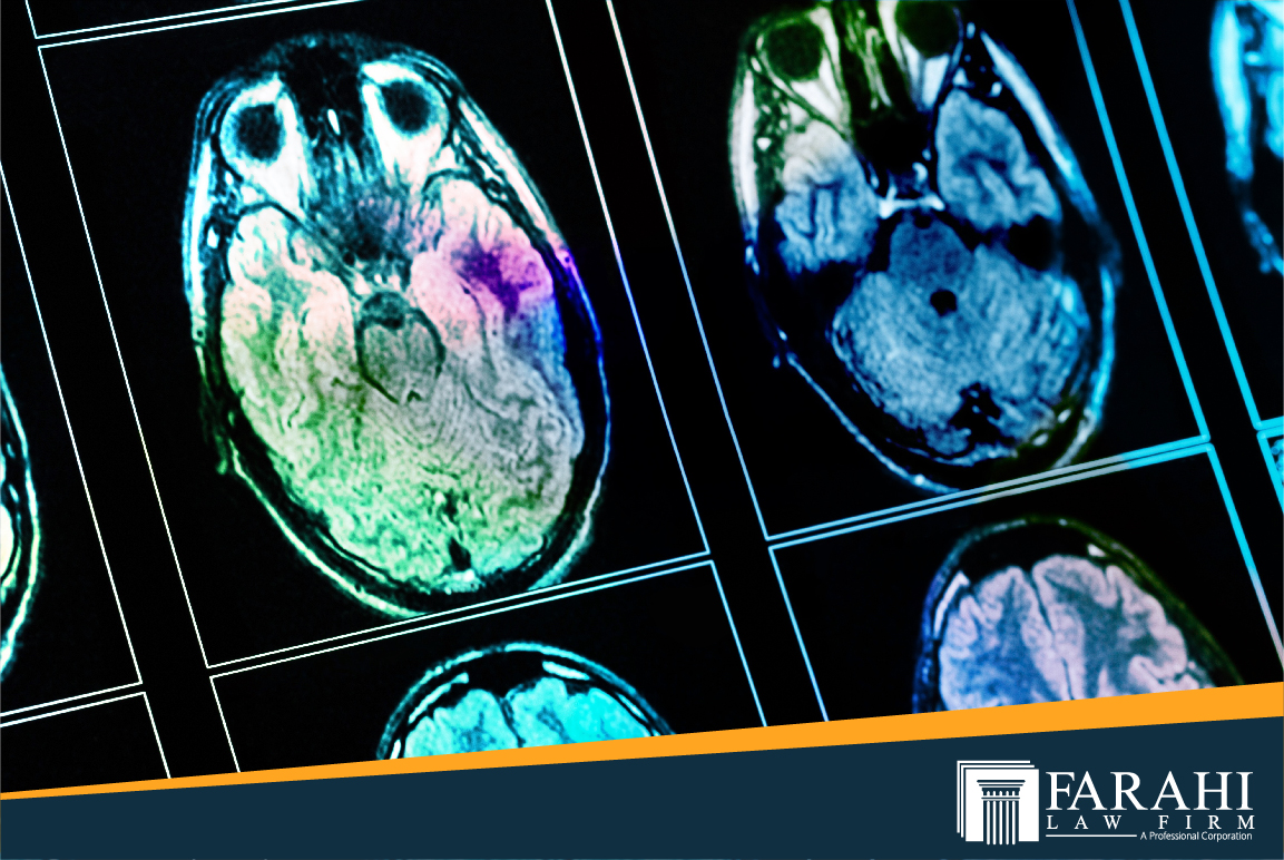 Interesting Facts About Traumatic Brain Injury: Types of TBI