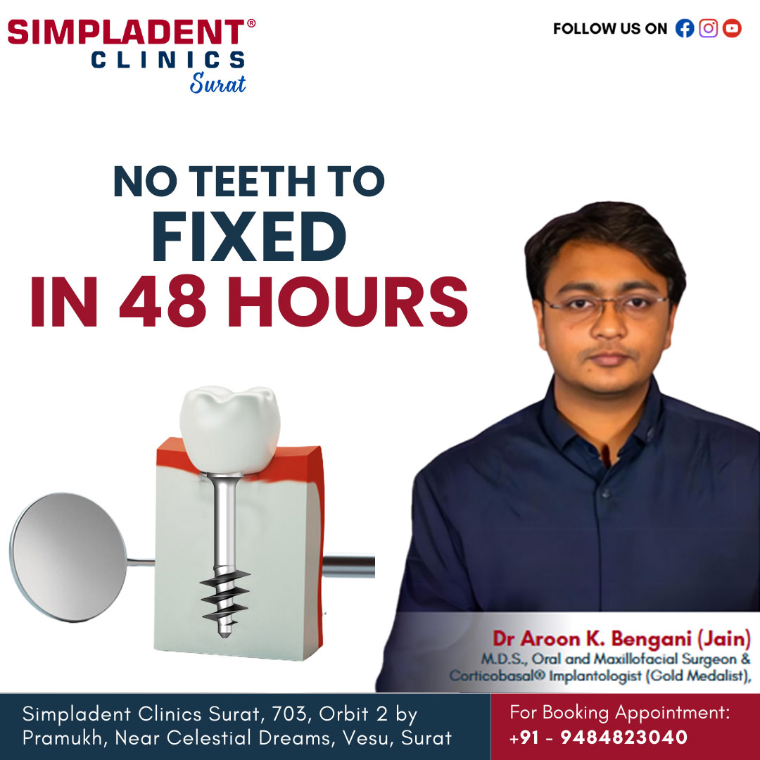How Getting Dental Implants in Just 2 Days is Possible in Today's World 
