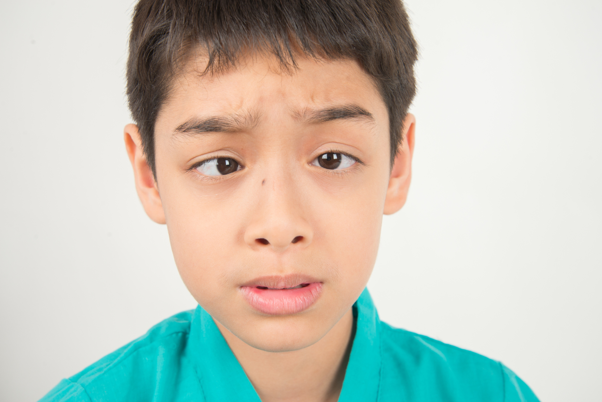 Correct Your Squint Today: Effective Exercises You Should Try