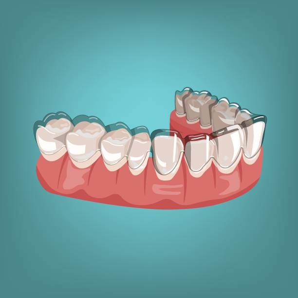 How can I straighten my teeth the right way?