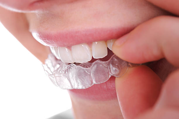 How Effective Is Invisalign For Complex Orthodontic Issues