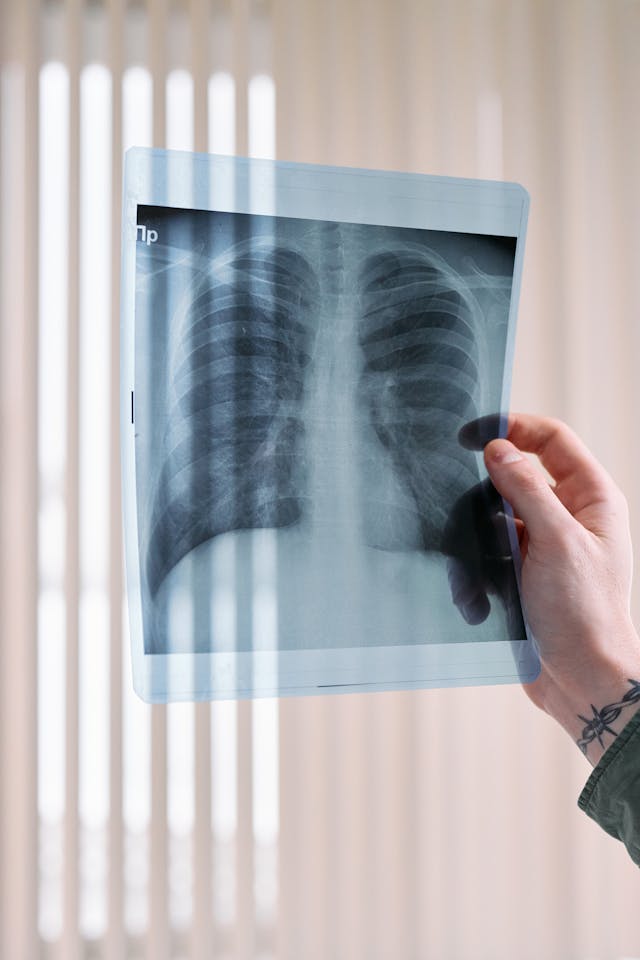 Lung Cancer Diagnostic And Screening Market Competitive Landscape 2024-2033 – Major Players and Strategies