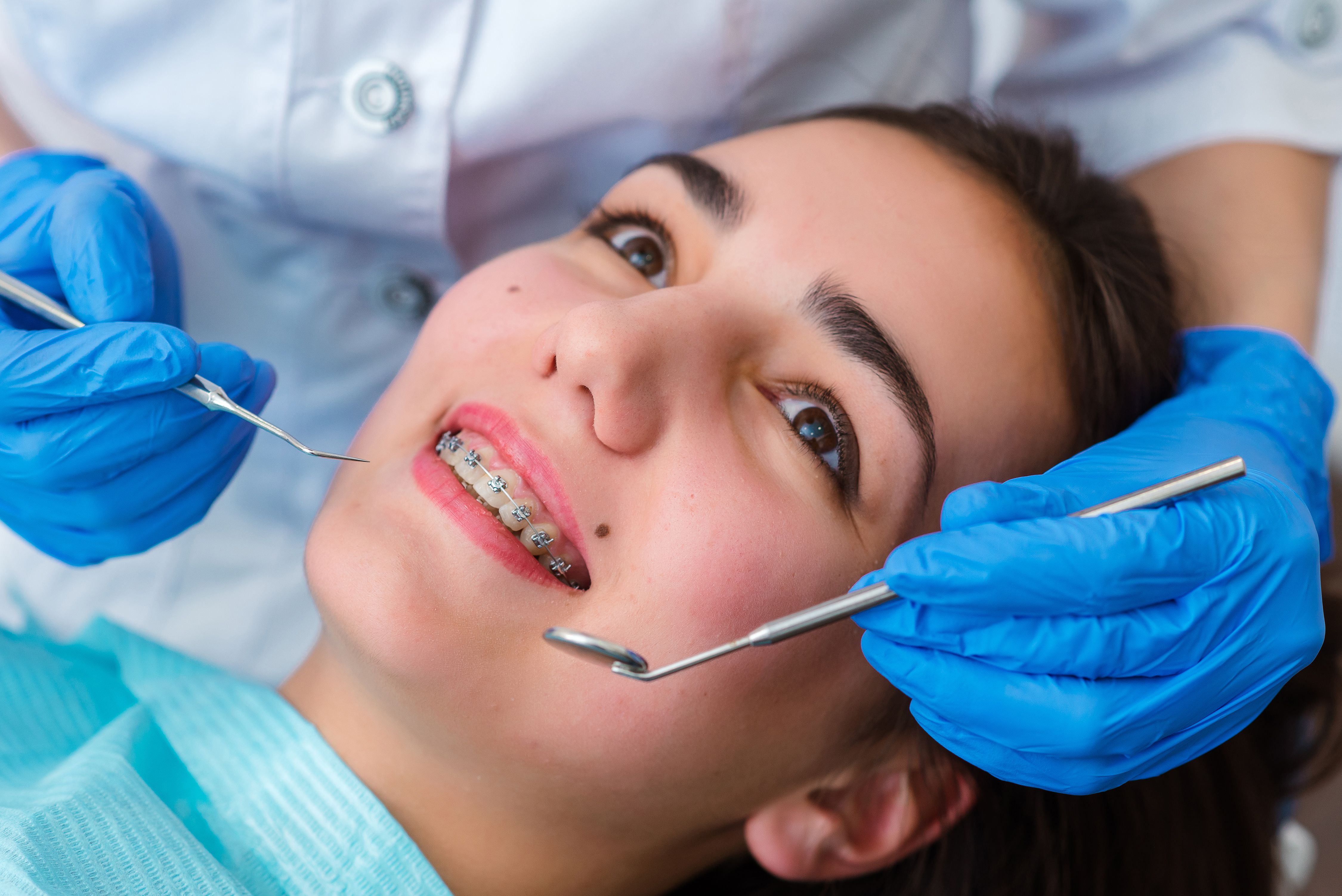Get Your Dream Smile Back! Dental Fillings Singapore: Quick & Easy Guide
