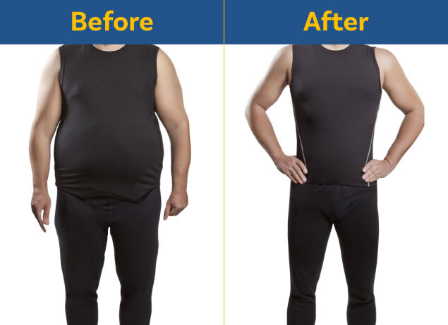 Bariatric Surgery vs. Weight Loss Surgery: What's the Difference?