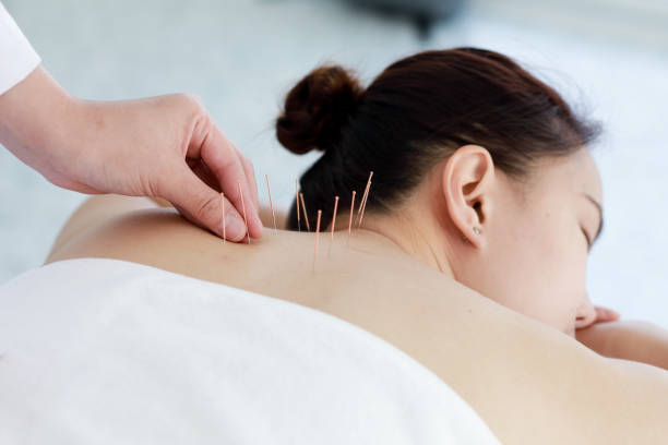 Why Ellicott City Residents Are Turning to Acupuncture for Whole-Body Wellness
