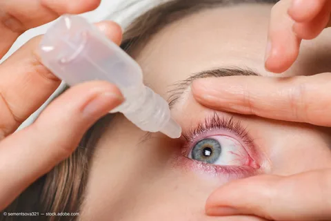 Ophthalmic Drugs Market Size & Share | Report 2023-33