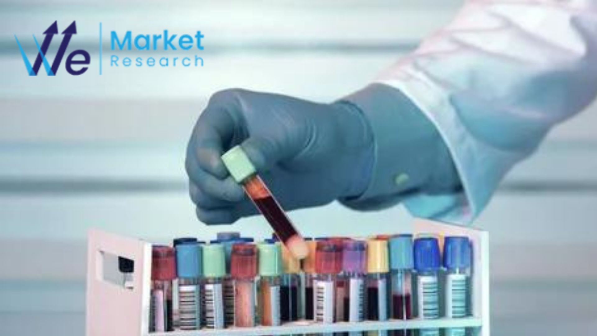 Biobanking Market Size Report 2023-2033