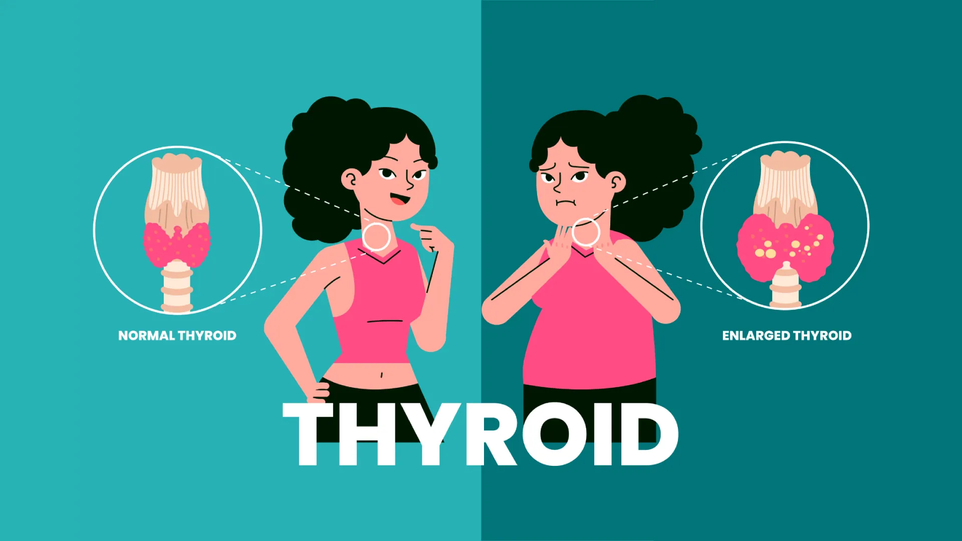 Thyroid Disorders: The Importance of Regular Testing for Mumbai Residents