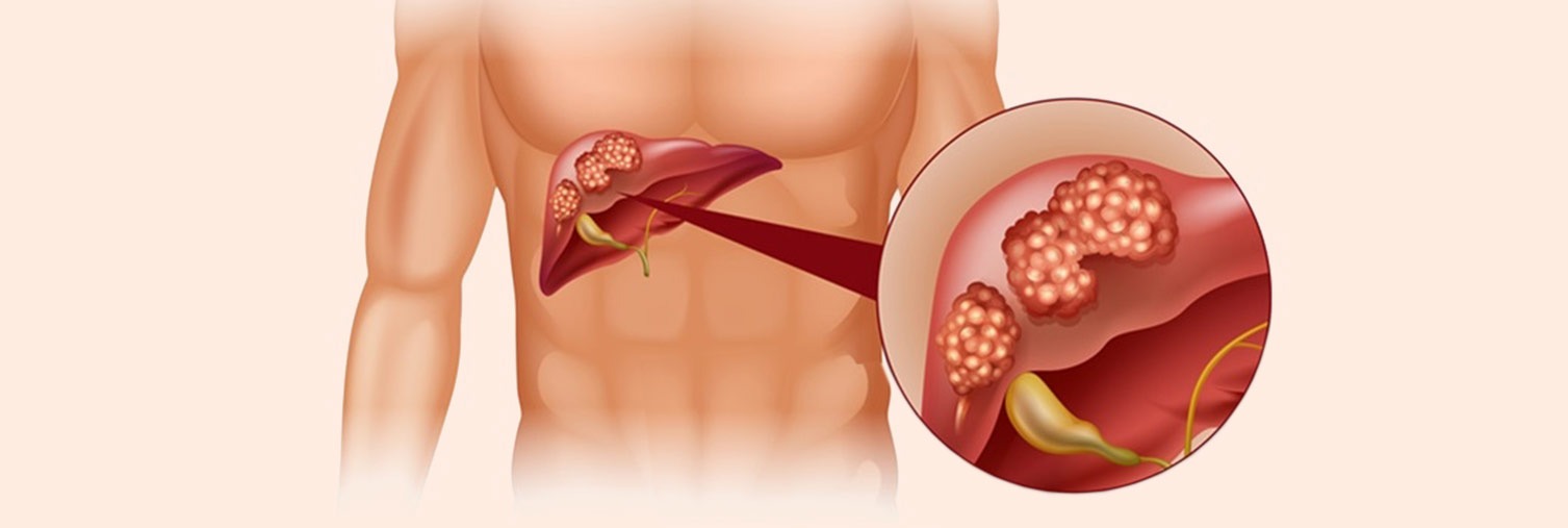 When Liver Health Needs Attention, Timely Care Matters Most