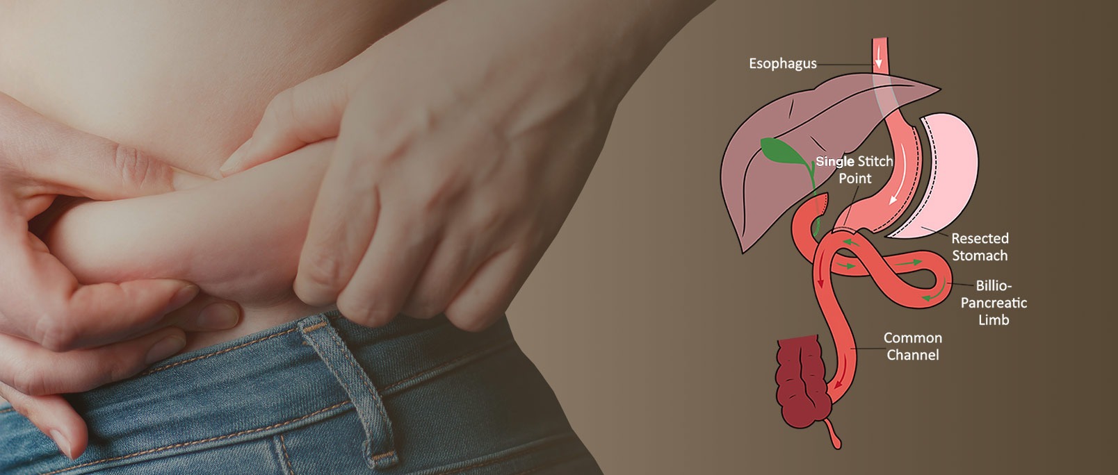 Transformative Weight Loss Solutions for a Healthier You