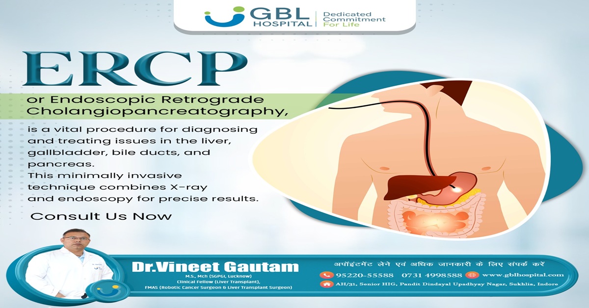 ERCP for Bile Duct Strictures: Causes, Diagnosis, and Treatment