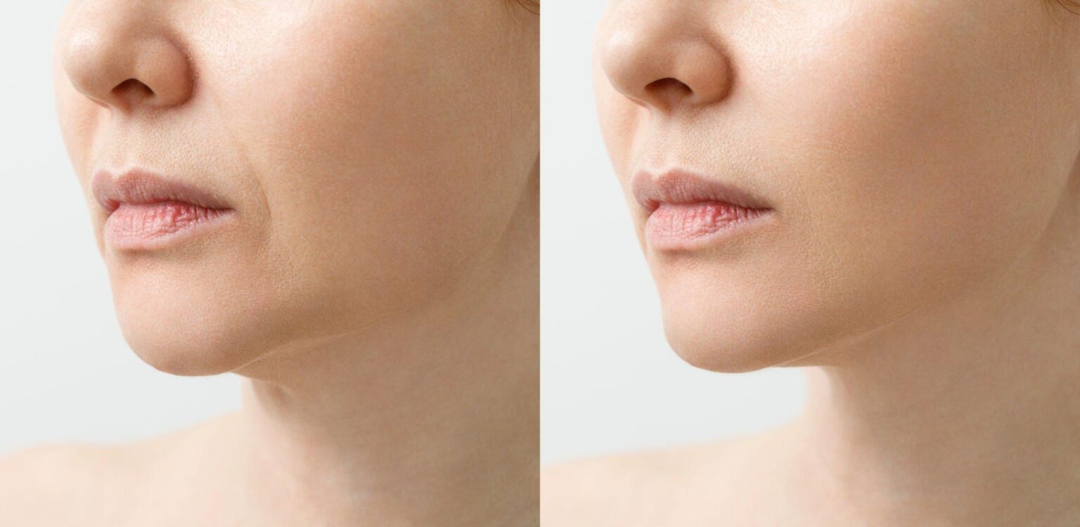 Transform Your Look with Trusted Aesthetic Expertise