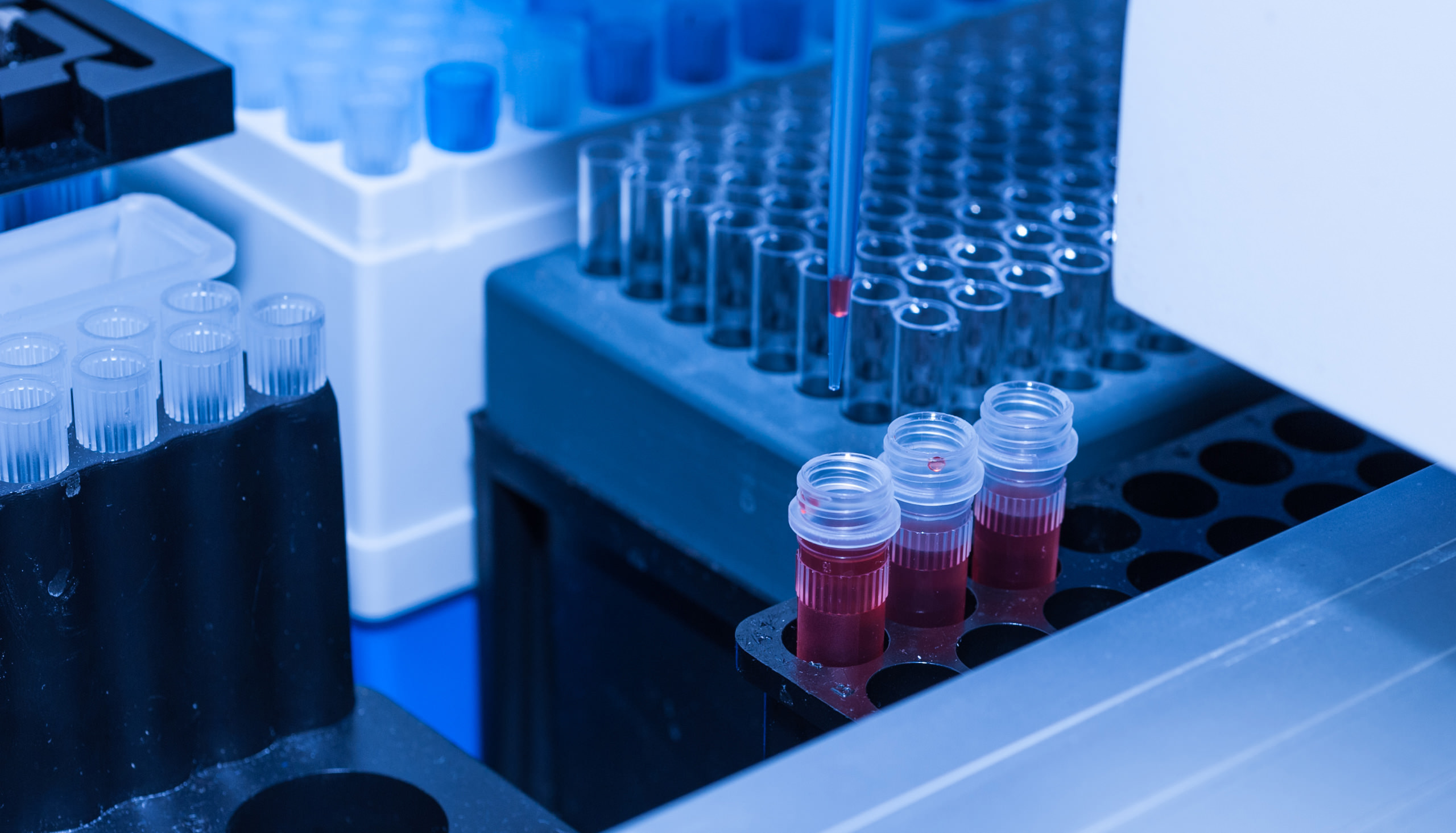 Transfection Reagents and Equipment Market Growth, Analysis and Forecast by 2031