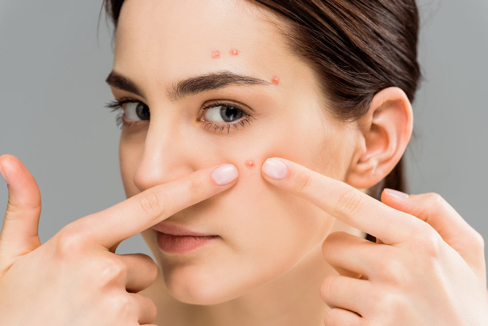 Acne Medication Market Challenges, Trend and Forecast by 2031