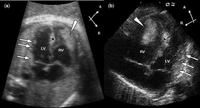 Fetal Echocardiogram Treatment | Healing Touristry