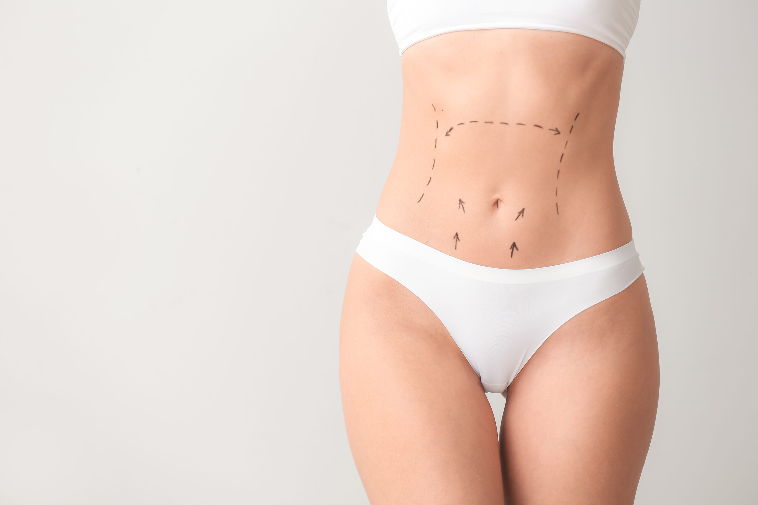 Tummy Tuck and Aging: Maintaining a Flat Stomach