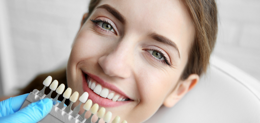 Achieving a Natural Look Within Dental Veneers Cost