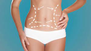 Transforming Your Midsection with a Tummy Tuck
