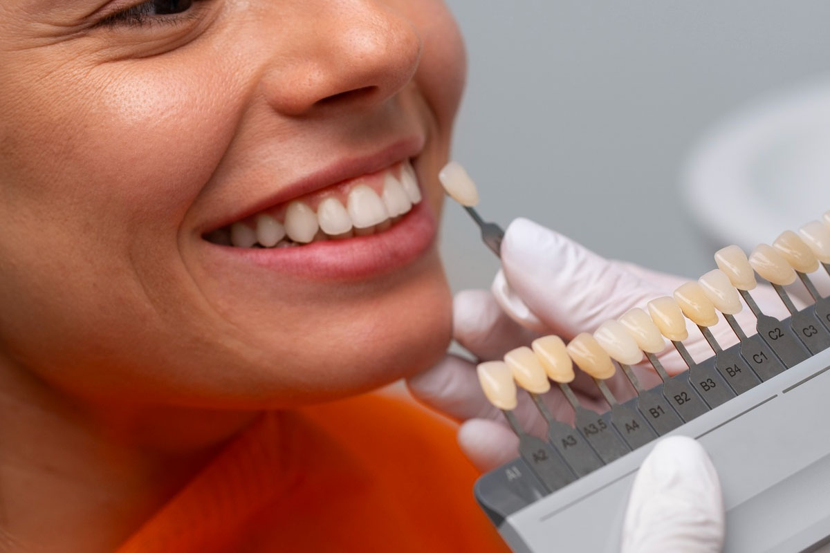 Solving Bite Issues with Dental Veneers