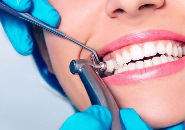 Can Teeth Scaling Improve Overall Oral Hygiene?