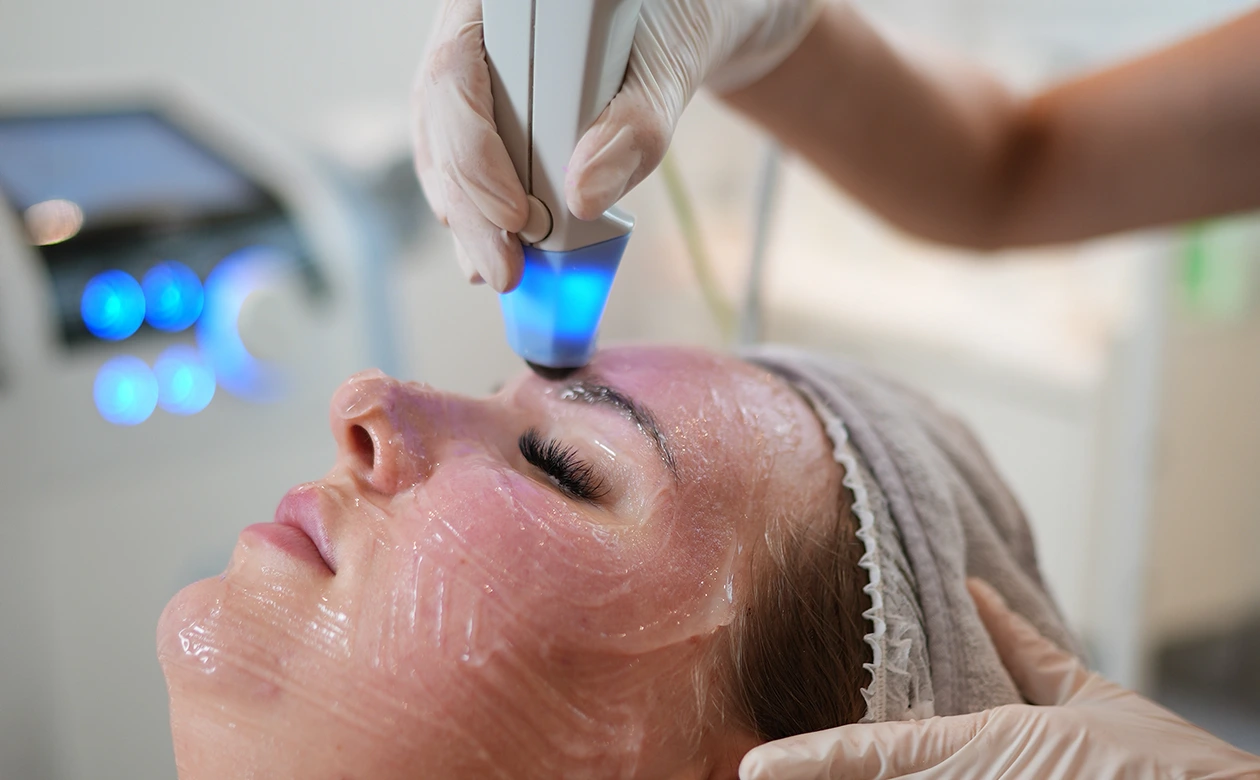 How Effective Is Exilis Treatment for Skin Tightening?