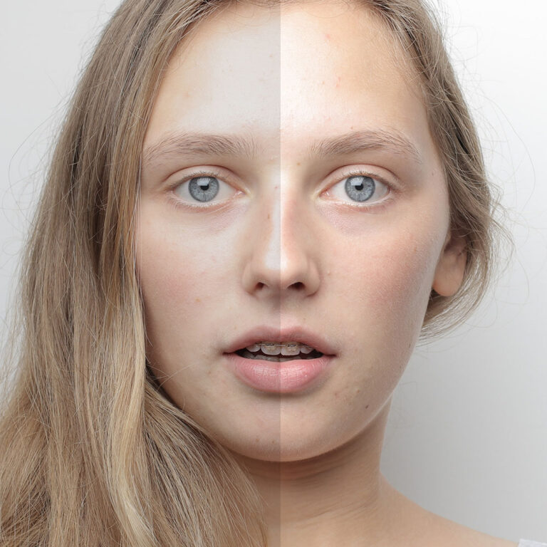 Understanding the Basics of Skin Correction