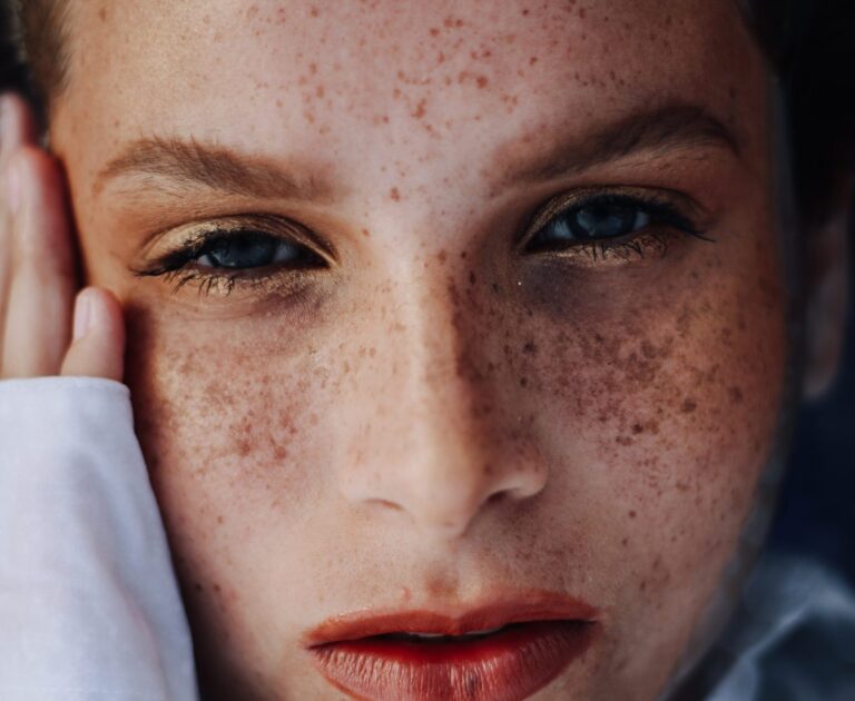 Understanding Congested Skin: Causes and Solutions