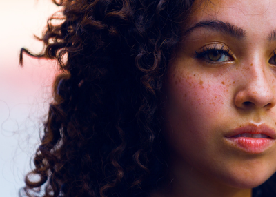 CBD Oil for Acne: Skin Care at its Best