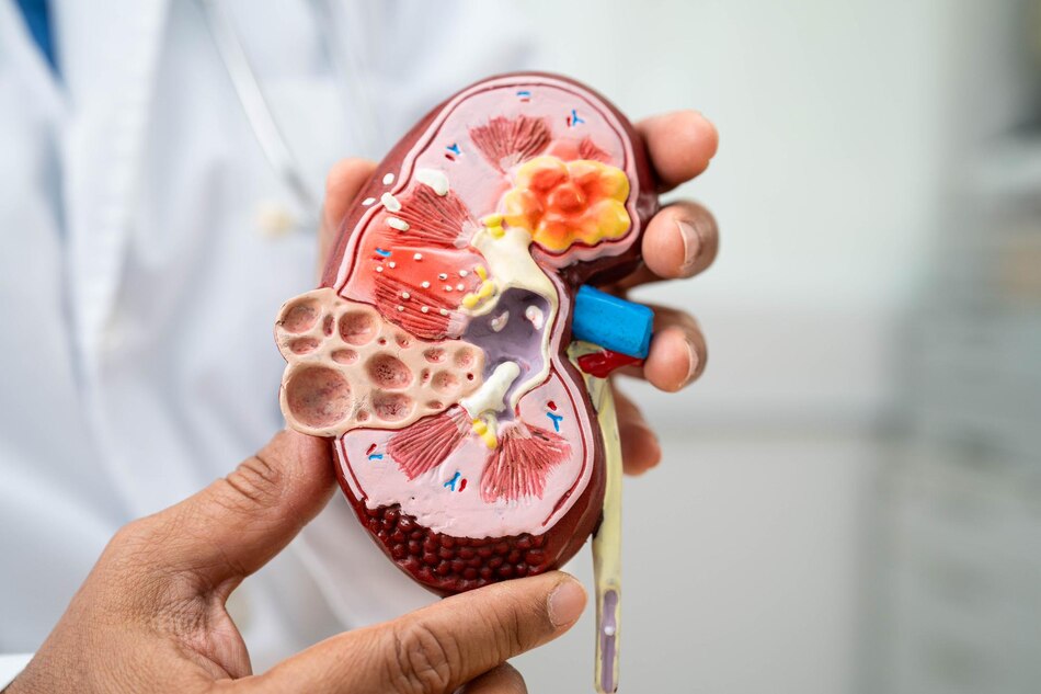 Ayurvedic Remedies for Kidney Failure: Healing Through Nature