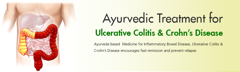 Take Online Ulcerative Colitis Treatment in Your Area
