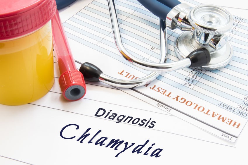 Chlamydia Infection Diagnostics and Therapeutics Market 2023 Size, Dynamics & Forecast Report to 2032