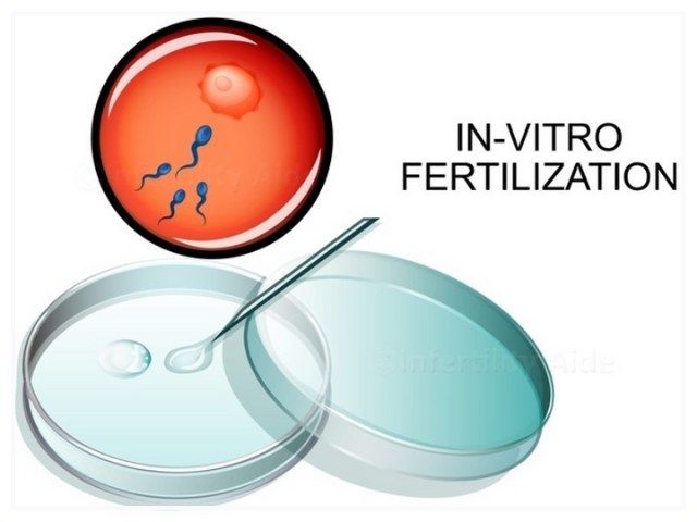 Report on In Vitro Fertilization Market Research 2032 - Value Market Research