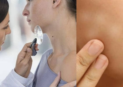 Jiotes, or White Spots on the Skin, Why they Leave and How to Cure them?