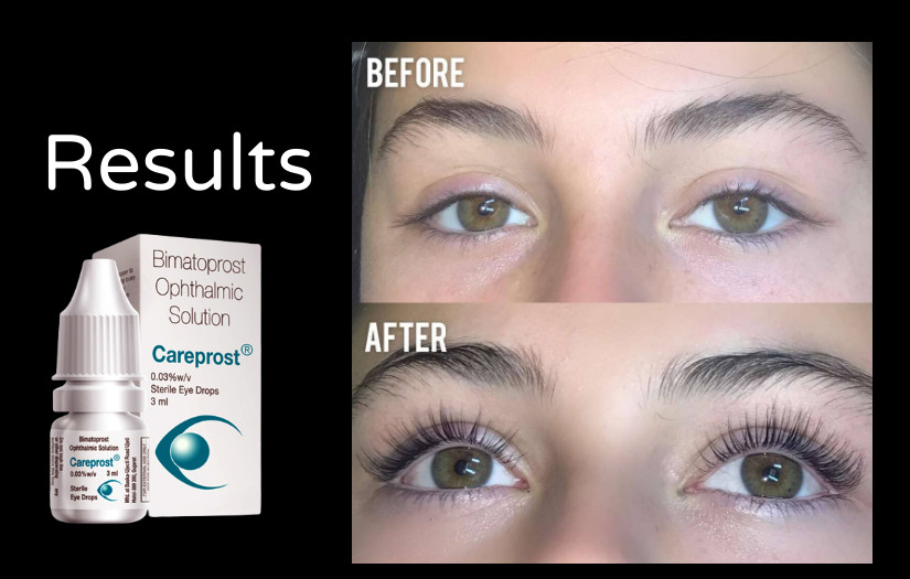 Careprost Eyelash Growth Serum