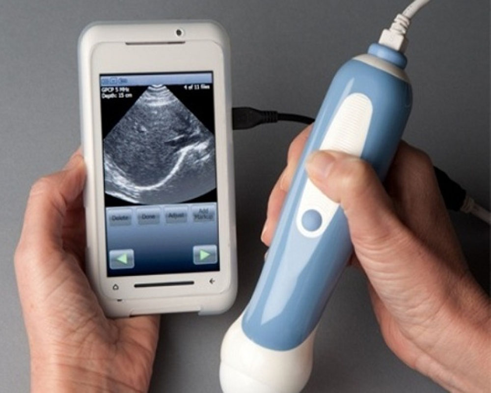 Navigating the Ultrasound Devices Market: Forecast & Emerging Trends