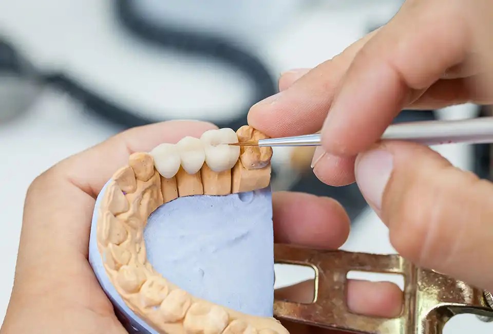 Understanding Dental Crowns: Protective Armor for Your Teeth