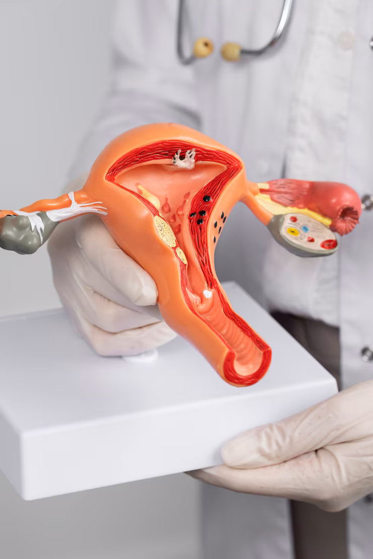 Exploring Different Types and Impacts of Uterus Removal Surgery in Greater Noida