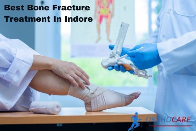 Best Bone Fracture Treatment In Indore