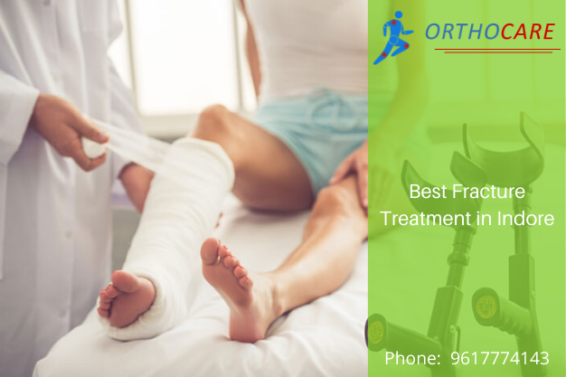 Best Fracture Treatment in Indore