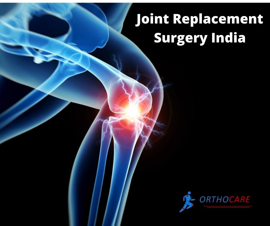 Best Joint Replacement Surgery in India