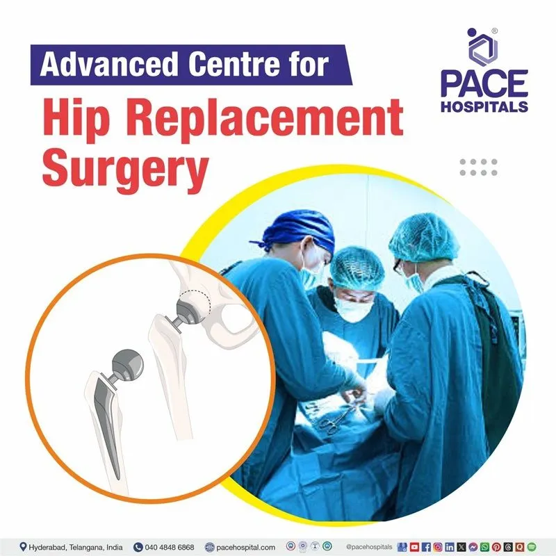 Best Knee Replacement Surgery in Hyderabad, India