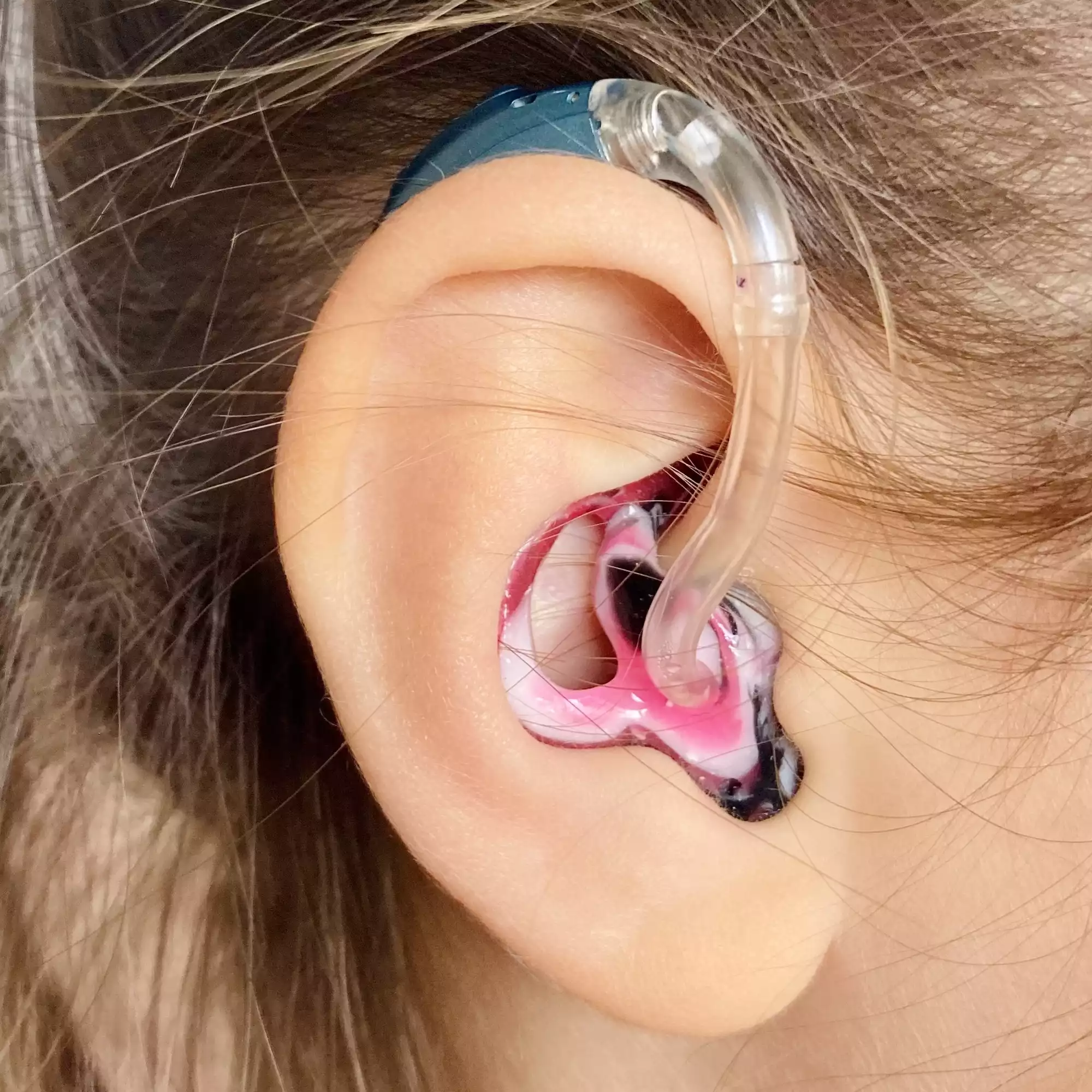 Choosing the Right Hearing Aid for the Elderly