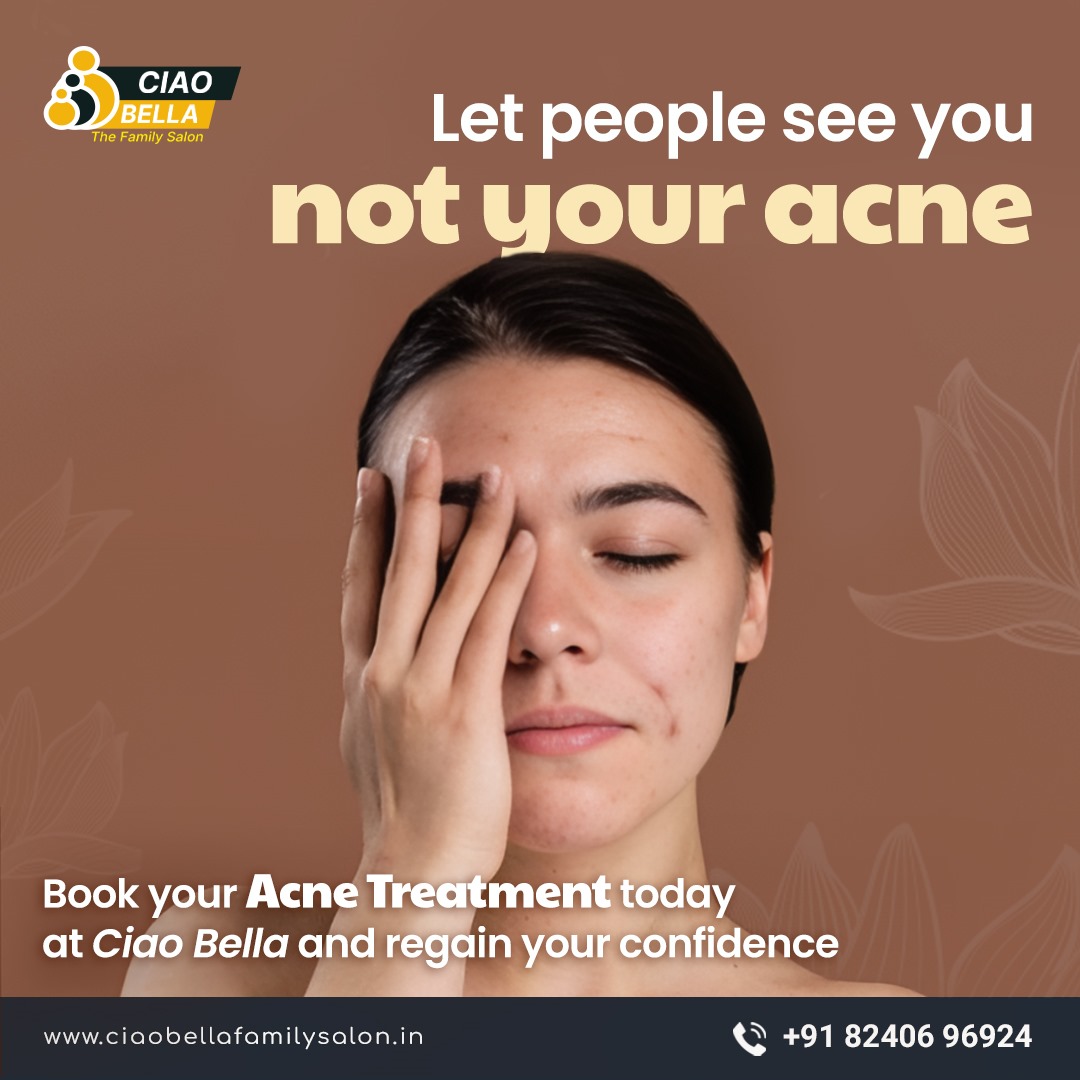 Why Ciao Bella Family Salon in Kasba is the Best Choice for Acne Treatment