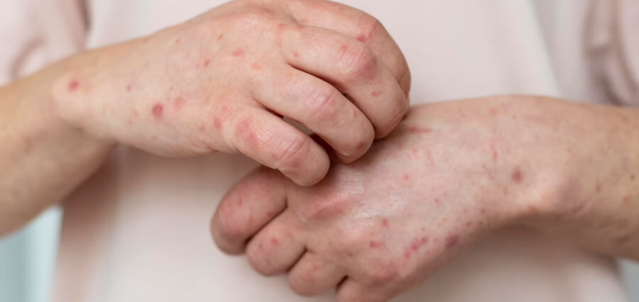 Understanding Skin Cancer Warning Signs