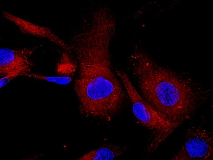 Mesenchymal Stem Cells: A Promising tool for Regenerative Medicine