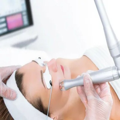 Medical Laser Systems Market is Estimated to Witness High Growth Owing to Advancements in Laser Technology