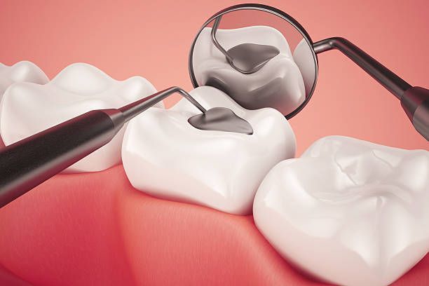 Dental Fillings in Cosmetic Dentistry: Restoring Function and Aesthetics! 