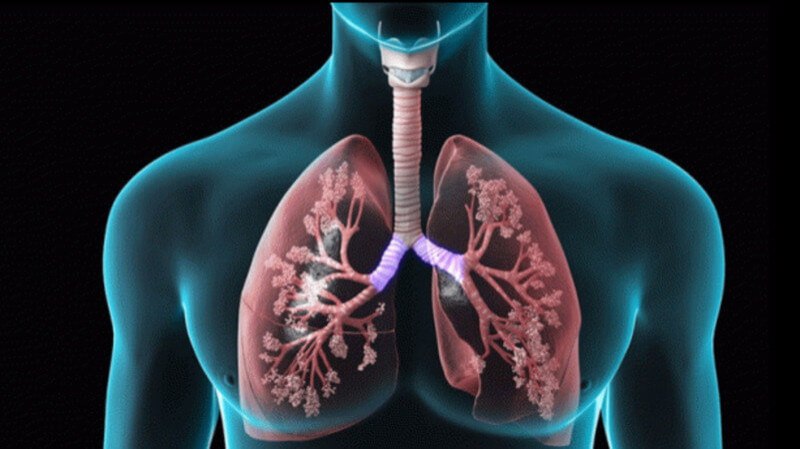 Key Trends Shaping the Chronic Obstructive Pulmonary Disease (COPD) Diagnosis Market